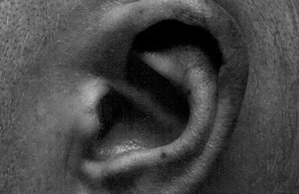 Graphic Study of an Ear